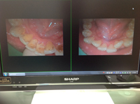 ���o���J�����@�摜